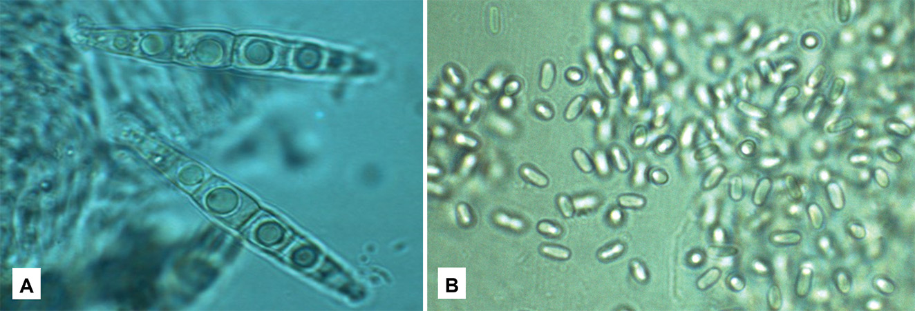 Microscopic closeups of Ascospores and pycnidiospores. They almost resemble nematodes with oblong rounded bodies.