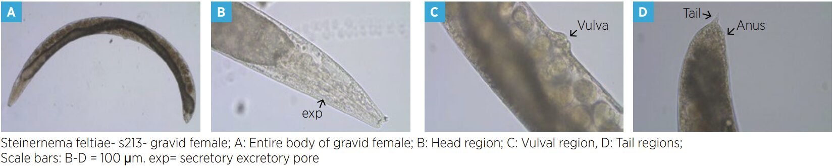 4 images of nematodes and their body parts. Please contact Jay Whetter for accessible versions of these images.